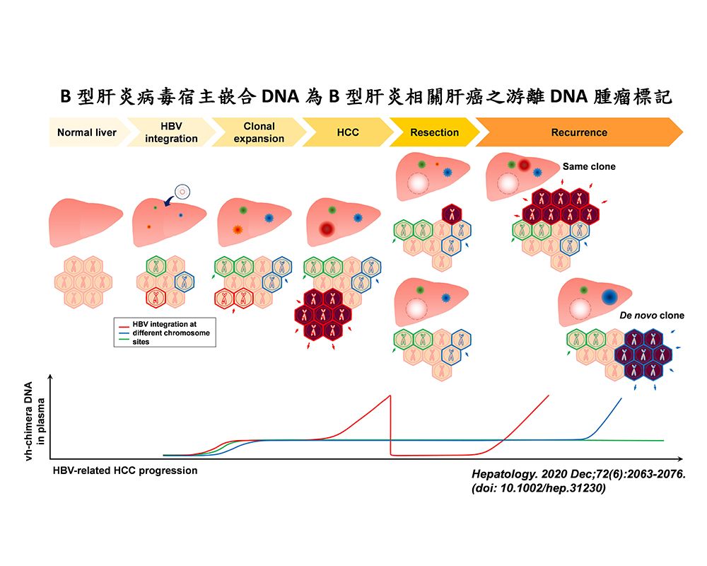 臺大肝炎研究團隊成功開發「病毒宿主嵌合DNA」 為B型肝炎病毒相關肝癌之新穎血液腫瘤標記-封面圖